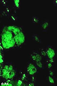 Kỹ thuật mới giúp phát hiện 
khối u ung thư