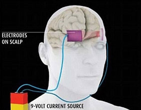 Kích thích điện não giúp 
tăng cường khả năng học hỏi
