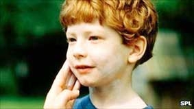 Người có da trắng cần 
bổ sung vitamin D