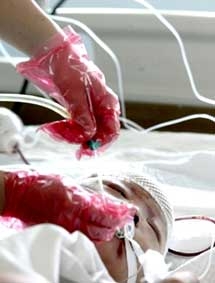 Vụ em bé bị bỏ mặc cho xe cán ở Trung Quốc <br>
Sức khỏe Yue Yue ngày càng nguy kịch