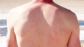 Dùng tế bào da để chữa trị ung thư