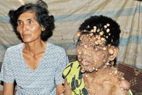 Người phụ nữ mắc bệnh lạ mong được giúp đỡ!