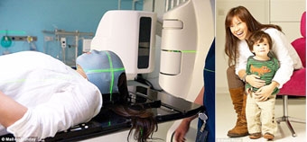 TrueBeam - Công nghệ xạ trị nhanh và chuẩn xác nhất thế giới