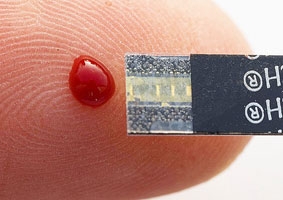 Chip sinh học phát hiện nhiễm trùng máu