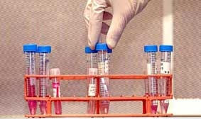 Phát triển tinh trùng trong phòng thí nghiệm