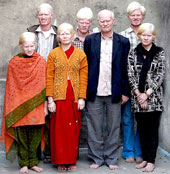 Gia đình bạch tạng