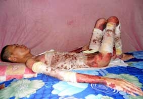 Xin cứu giúp Nguyễn Minh Thuận !