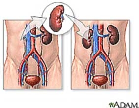Qui trình ghép tạng mới giúp ngăn ngừa thải ghép