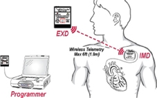 Thiết bị cảnh báo sớm cơn đau tim