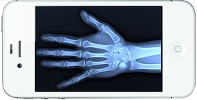 Công nghệ biến thiết bị di động thành máy quét ảnh cầm tay