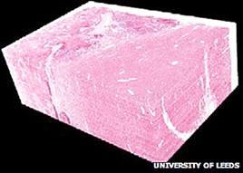 Ứng dụng công nghệ 3D trong chẩn đoán và điều trị ung thư