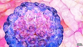 1/6 ca ung thư trên thế giới là do nhiễm trùng