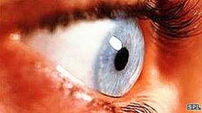 Ghép tế bào gốc vào mắt 
để khôi phục thị lực