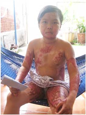 Trao tiền từ thiện