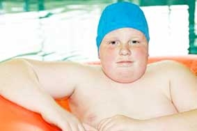 Trẻ em béo phì có nguy cơ bị mù lòa