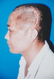 Hãy giúp Hoàng Anh ghép sọ nhân tạo!