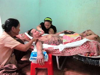 Giúp chị Nương vượt qua đau đớn vì bệnh tật