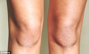 Khi robot trở thành các bác sĩ phẫu thuật