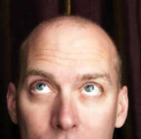 Sắp có thuốc trị hói đầu