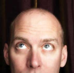 Sắp có thuốc trị hói đầu