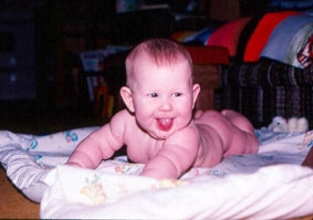 Trẻ dùng kháng sinh sớm 
dễ bị béo phì