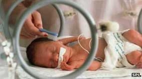 Bỏ thai nhiều lần tăng nguy cơ sinh non