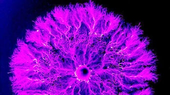 Cắt đứt sự giao tiếp của tế bào - 
phương thức mới chống ung thư ?