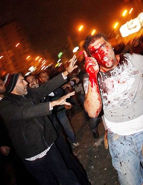 Ai Cập: Hai phe biểu tình đụng độ, 
hàng trăm người thương vong