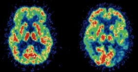 "Bí quyết" để cải thiện trí não