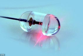 Camera nội soi giúp phát hiện sớm ung thư thực quản