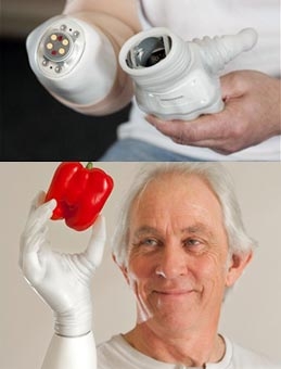 Bàn tay điện tử dành cho người khuyết tật