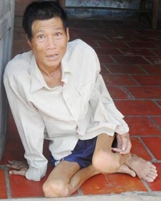 Chú Sũng rất cần được giúp đỡ!