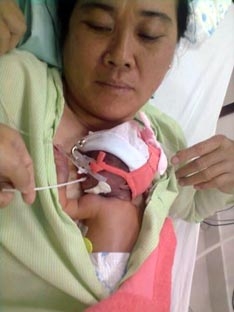 Bệnh viện Phụ sản Quốc tế Phương Châu
Áp dụng phương pháp Kangaroo sớm nuôi bé sơ sinh cực non tháng
