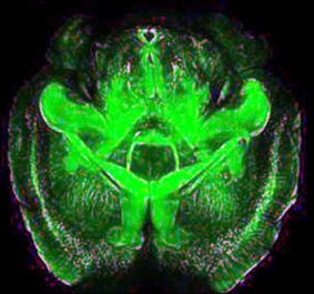 Bước tiến mới trong khám phá bí ẩn não bộ
