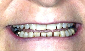 Sắc vóc biểu thị cả lối sống lẫn tình trạng sức khỏe