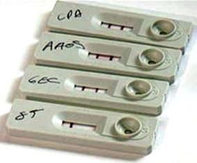 Thiết bị xét nghiệm nhanh 

bệnh phong