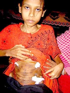 Mỗi giờ, một phụ nữ chết vì của hồi môn