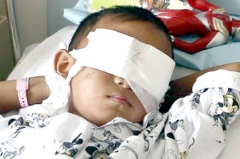 Vụ bé trai bị móc mắt ở Trung Quốc: Nghi phạm là bác dâu