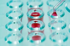 Mũi nhân tạo “đánh hơi” nhanh nhiễm trùng máu