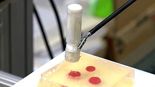 Thiết bị hỗ trợ phẫu thuật không xâm lấn