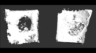 Cao dán sinh học giúp tái tạo xương một cách tự nhiên