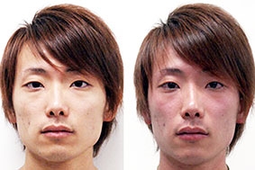 Người uống rượu bị đỏ mặt nên cẩn trọng!