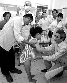 Ứng dụng tiêm thuốc Dysport trong điều trị 
co cứng chi dưới ở trẻ bại não