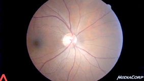 Chụp ảnh võng mạc bà bầu giúp 
đánh giá sự phát triển của thai nhi