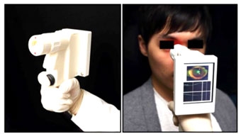 Kiểm tra mắt nhanh gọn với máy quét cầm tay