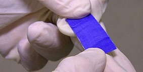 Miếng dán tự phân hủy hỗ trợ quá trình phẫu thuật