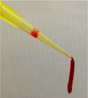 Collagen nhân tạo làm lành vết thương một cách tự nhiên