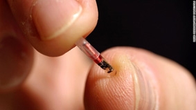 Thời của các thiết bị điện tử cấy ghép