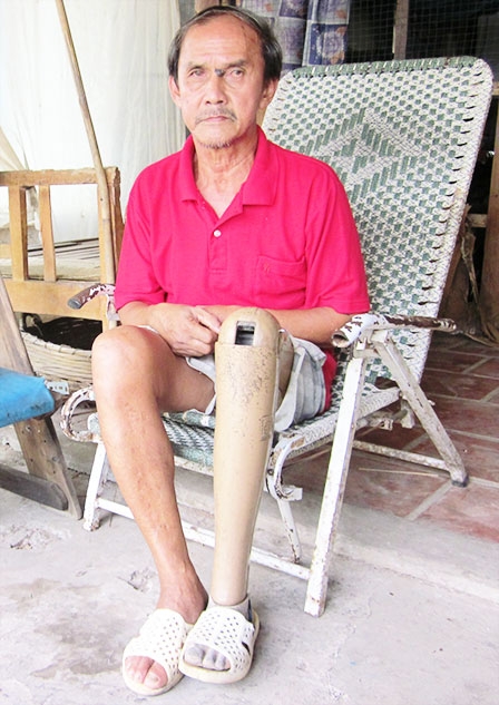 Ông Dư mong có điều kiện trị bệnh