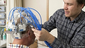 Nón chẩn đoán sớm đột quị